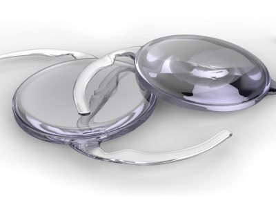 Les Implants Intraoculaires, choix et techniques de pose